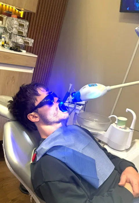 Blanqueamiento dental en consultorio en Elite Clinic Dental & Medical, Bosques de las Lomas, CDMX